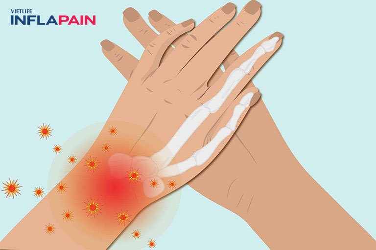 Thoái hóa khớp cổ tay: Nguyên nhân - Triệu chứng - Cách điều trị 2